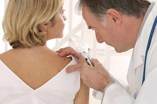 Sun Spots Removal, Pigmentation Removal
