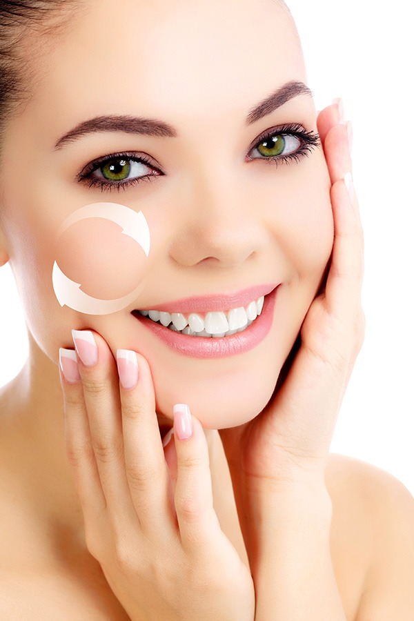 Radiesse Treatment